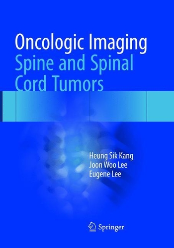 Паперова книга «Oncologic Imaging: Spine and Spinal Cord Tumors», авторів Юджин Лі, Хьонг Сік Канг, Чжун Ву Лі - фото №1