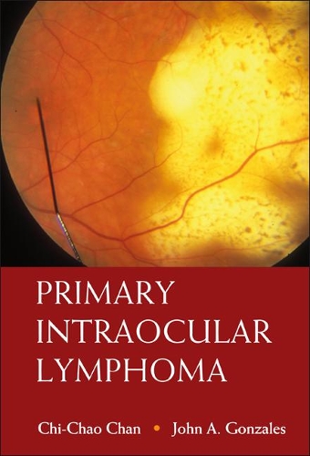 Бумажная книга «Primary Intraocular Lymphoma», авторов Чи-чао Чан, Джон А Гонсалес - фото №1