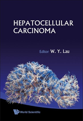 Бумажная книга «Hepatocellular Carcinoma», автор Джозеф В. Й. Лау - фото №1
