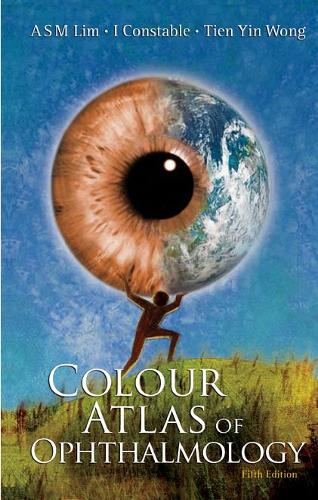 Паперова книга «Colour Atlas Of Ophthalmology (Fifth Edition)», авторів Артур С. М. Лім, Ієн Джей Констебл, Тянь Інь Вонг - фото №1