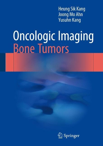 Паперова книга «Oncologic Imaging: Bone Tumors», авторів Хьонг Сік Канг, Чжун Мо Ан, Юсун Кан - фото №1