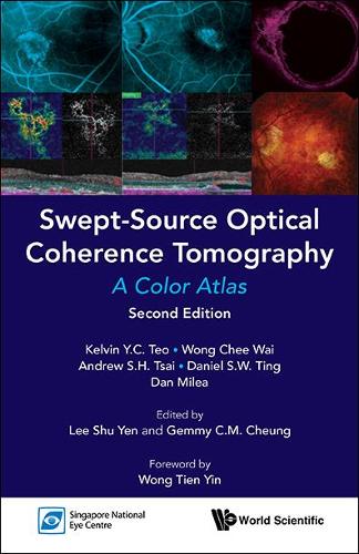 Бумажная книга «Swept-Source Optical Coherence Tomography : A Color Atlas: 2nd Edition», авторов Эндрю С. Х. Цай, Чи Вай Вонг, Дэн Милеа, Дэниел С. В. Тинг, Кельвин И. Ч. Тео - фото №1