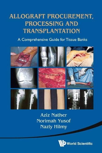 Паперова книга «Allograft Procurement, Processing And Transplantation: A Comprehensive Guide For Tissue Banks», автор Абдул Азіз Натер - фото №1