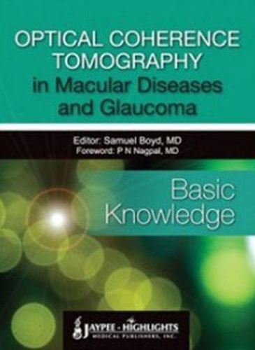 Паперова книга «Optical Coherence Tomography in Macular Diseases and Glaucoma: Basic Knowledge», автор Семюель Бойд - фото №1