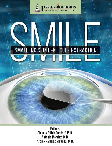 Бумажная книга «SMILE: Small Incision Lenticule Extraction», авторов Антонио Мендес, Артуро Рамирес-Миранда - фото №1