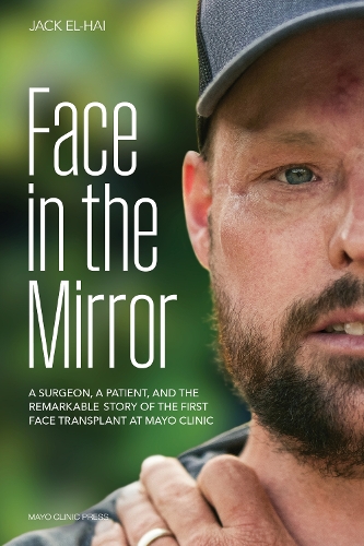 Паперова книга «Face Transplant: How Medical Science Gave a Man a New Face and Restored His True Identity», автор Джек Ель-Хай - фото №1