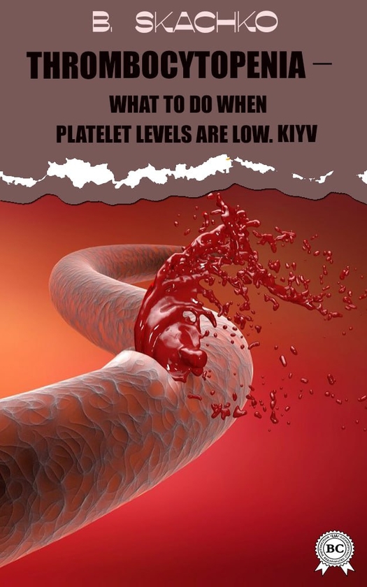 Електронна книга «Thrombocytopenia – What to Do When Platelet Levels Are Low», автор Борис Скачко - фото №1