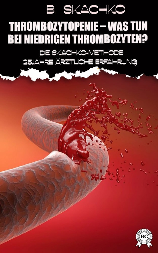 Электронная книга «Thrombozytopenie – was tun bei niedrigen Thrombozyten?», автор Борис Скачко - фото №1