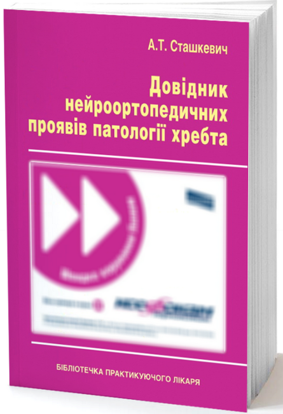 [object Object] «Довідник нейроортопедичних проявів патології хребта», автор Анатолий Сташкевич - фото №1