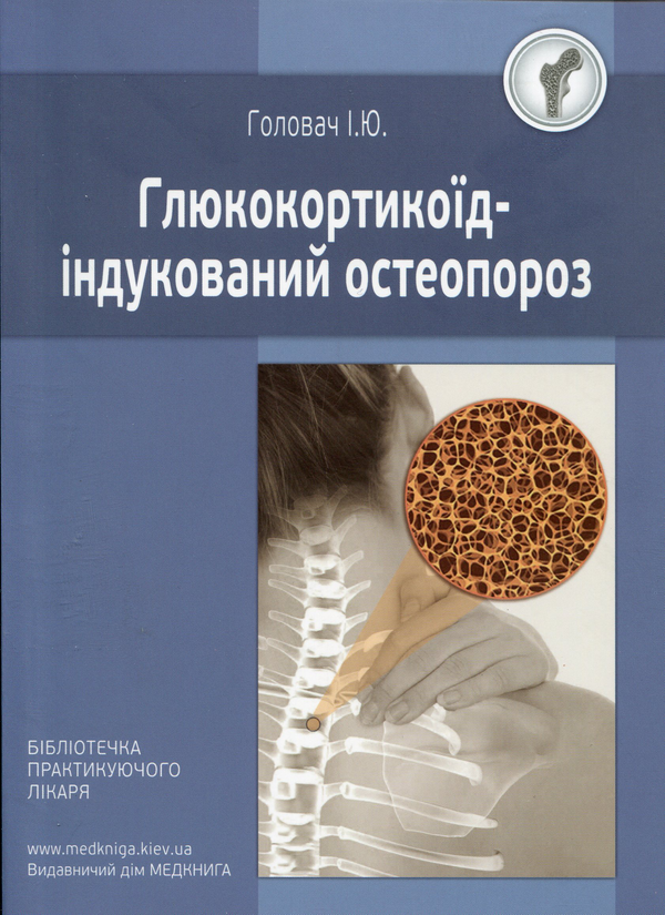 [object Object] «Глюкокортикоїд-індукований остеопороз», автор І. Головач - фото №1