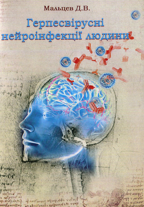 Книга Герпесвірусні нейроінфекції людини
