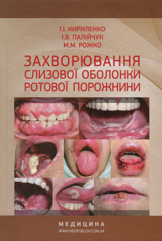 Книга Захворювання слизової оболонки ротової порожнини