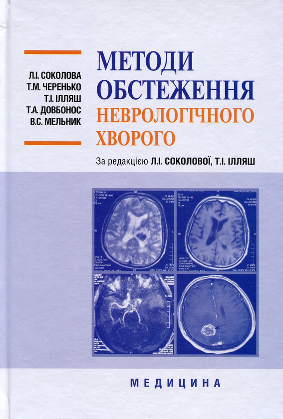 Паперова книга «Методи обстеження неврологічного хворого. Навчальний посібник для мед. ВНЗ ІІІ-ІV р.а. », автор Лариса Соколова - фото №1