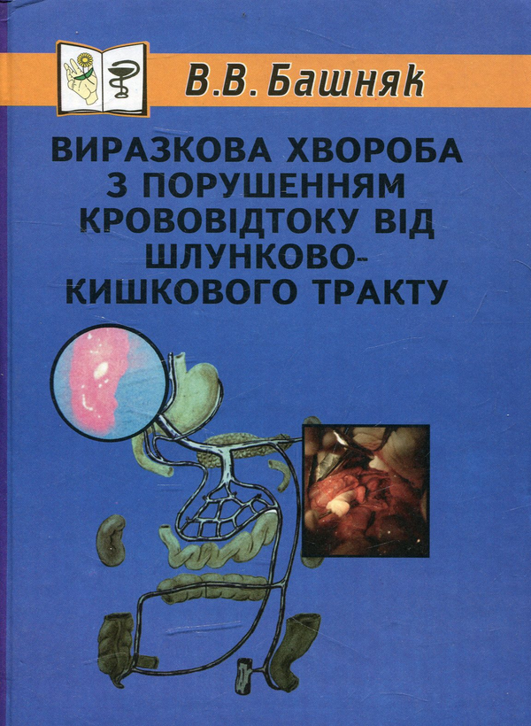 Бумажная книга «Виразкова хвороба з порушенням крововідтоку від шлунково-кишкового тракту», автор Василий Бишняк - фото №1