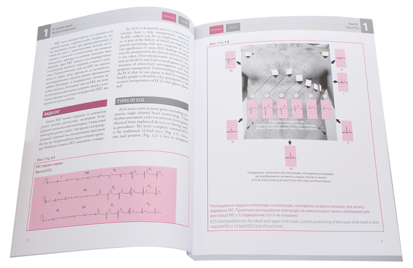 Бумажная книга «ЕКГ у практиці / The ECG Made Practical», автор Джон Хэмптон - фото №1