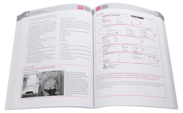 Бумажная книга «ЕКГ у практиці / The ECG Made Practical», автор Джон Хэмптон - фото №1