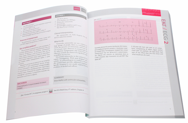 Бумажная книга «150 випадків ЕКГ / 150 ECG Cases», авторов Джон Хэмптон, Джоанна Хэмптон - фото №1