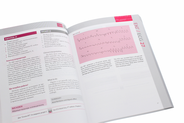 Бумажная книга «150 випадків ЕКГ / 150 ECG Cases», авторов Джон Хэмптон, Джоанна Хэмптон - фото №1