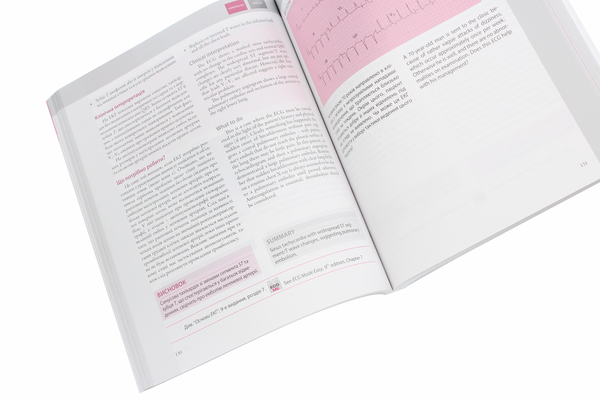 Бумажная книга «150 випадків ЕКГ / 150 ECG Cases», авторов Джон Хэмптон, Джоанна Хэмптон - фото №1