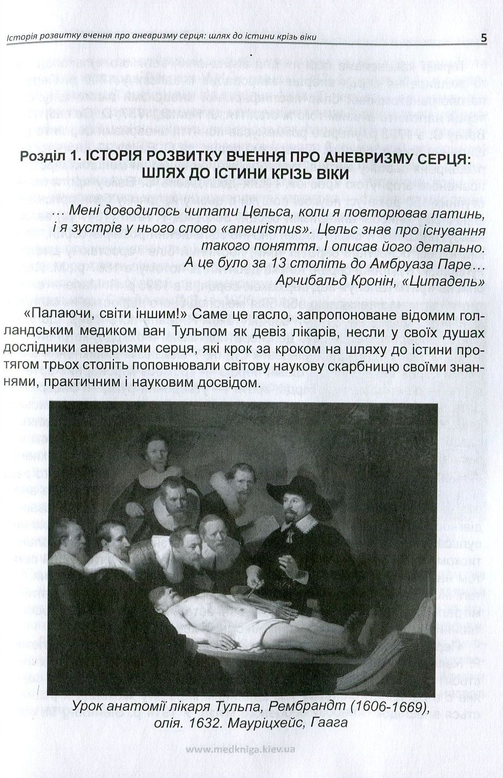 Хронічна постінфарктна аневризма серця — фото 4