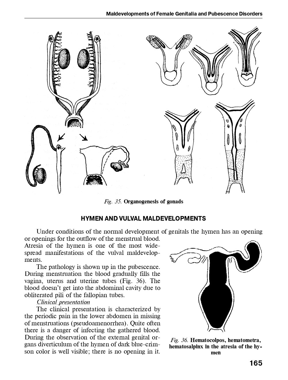 Obstetrics and Gynecology. In 2 volumes. Volume 2. Gynecology — фото 5