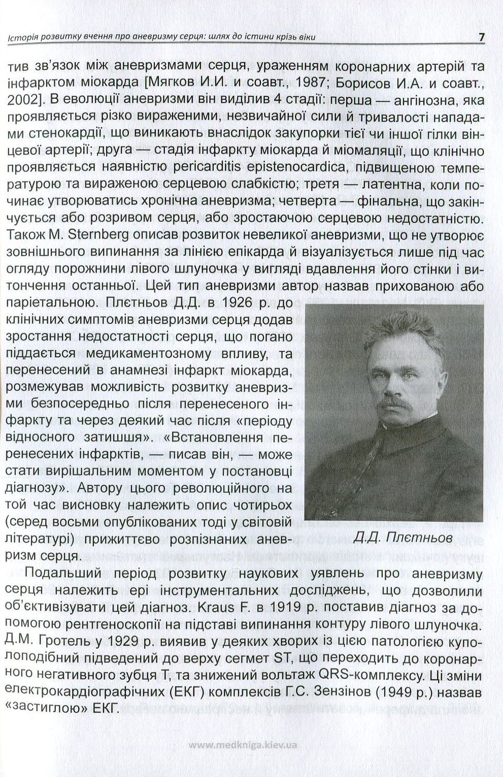 Хронічна постінфарктна аневризма серця — фото 6