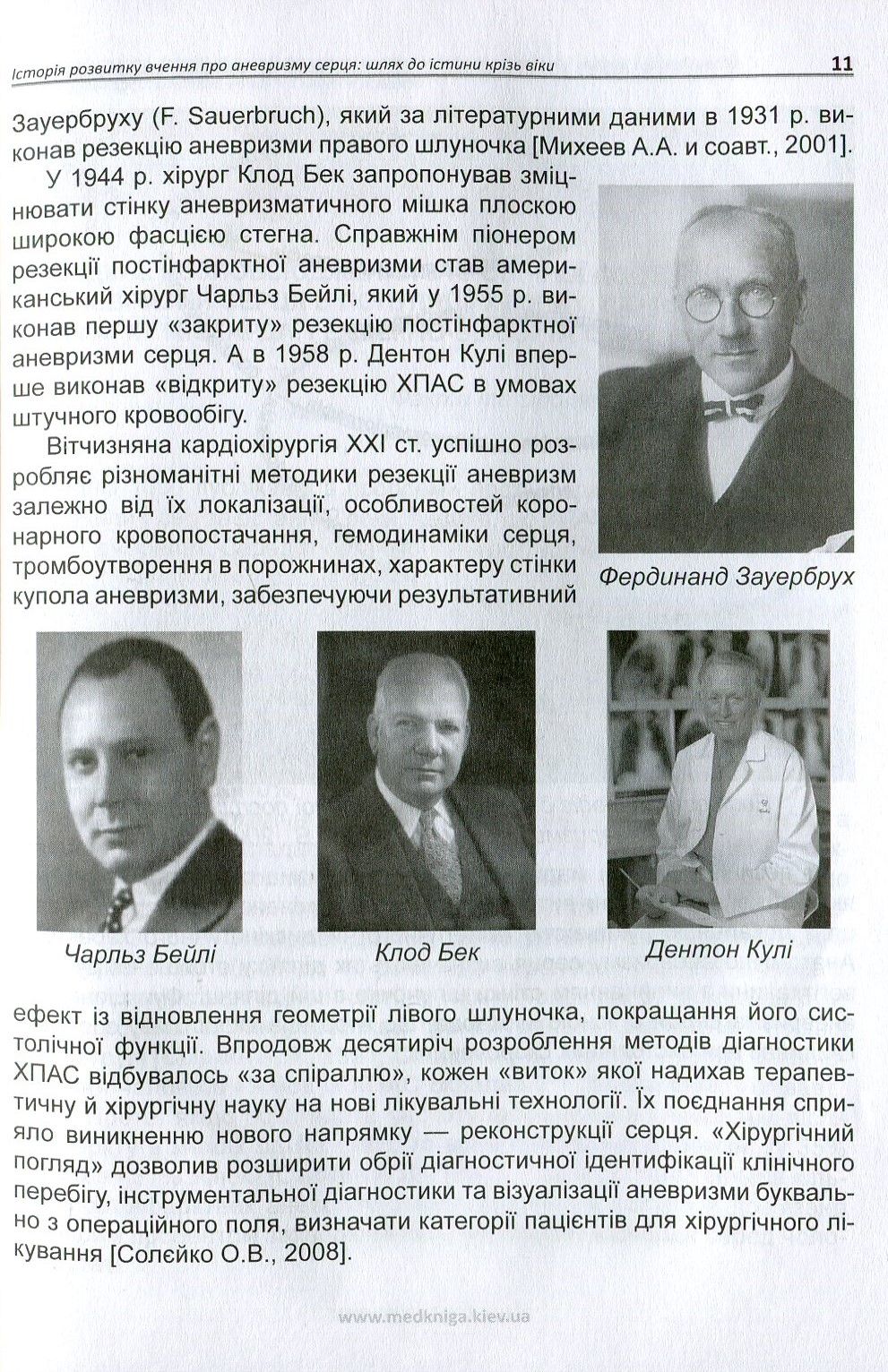 Хронічна постінфарктна аневризма серця — фото 10