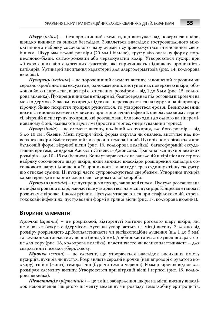 Інфекційні хвороби у дітей — фото 9