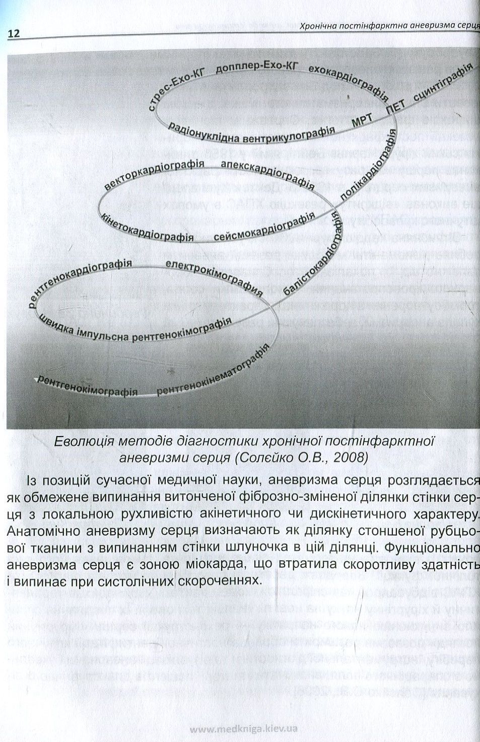 Хронічна постінфарктна аневризма серця — фото 11