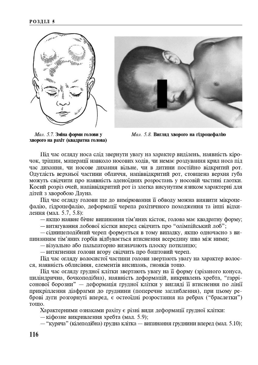 Педіатрія з курсом інфекційних хвороб — фото 13