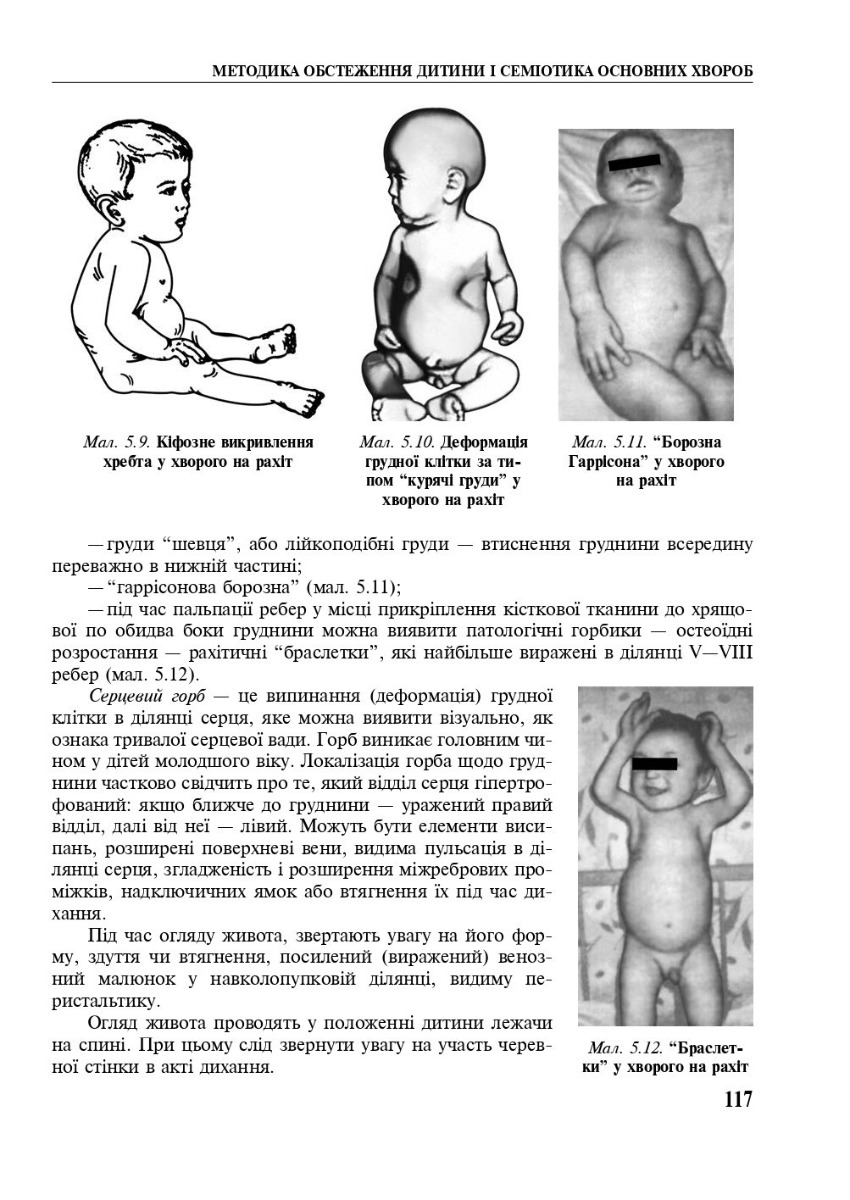 Педіатрія з курсом інфекційних хвороб — фото 14