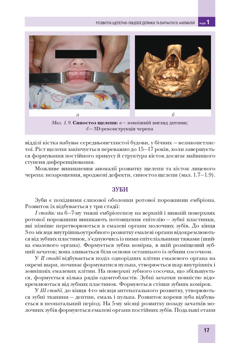 Хірургічна стоматологія та щелепно-лицева хірургія дитячого віку — фото 16