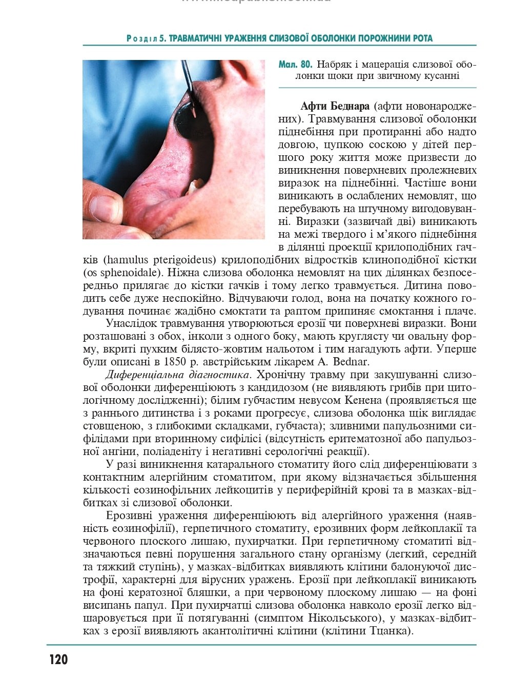 Терапевтична стоматологія у 4 томах. Том 4. Захворювання слизової оболонки порожнини рота — фото 23