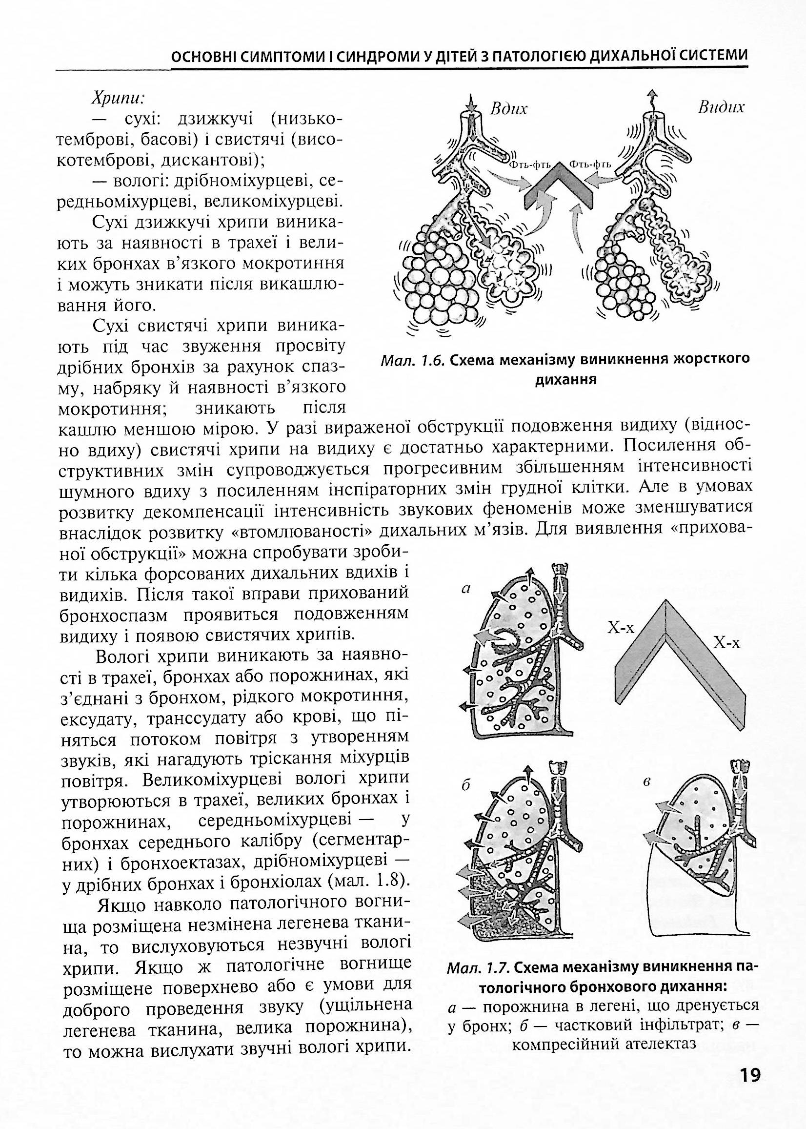 Дитяча пульмонологія. Навчальний посібник — фото 19